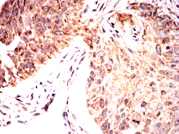 RAPGEF3 Antibody