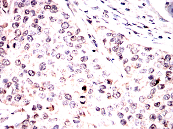 HMGA2 Antibody