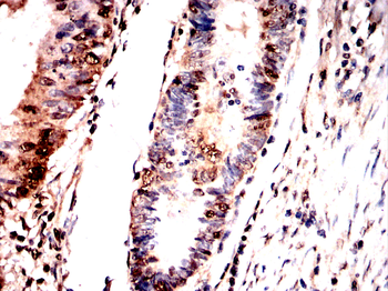 HMGA2 Antibody