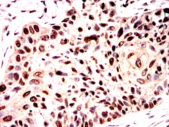 HMGA2 Antibody