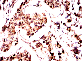 HMGA2 Antibody