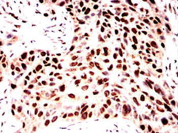 HMGA2 Antibody