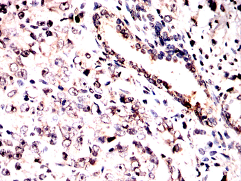 HMGA2 Antibody