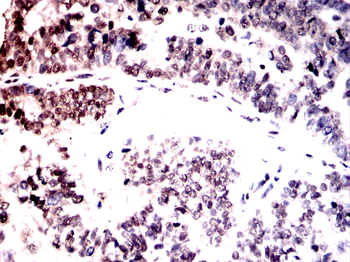 HMGA2 Antibody