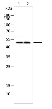 MCU Antibody