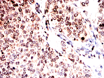 XIAP Antibody