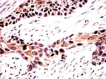 XIAP Antibody