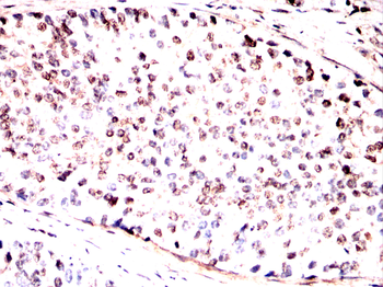 XIAP Antibody