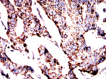SIGMAR1 Antibody