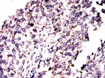 SIGMAR1 Antibody