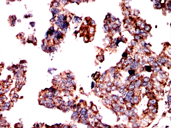 SIGMAR1 Antibody