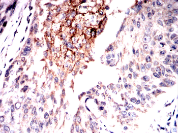 bglap2 Antibody