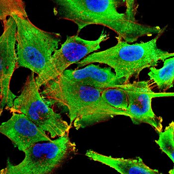 GLS Antibody