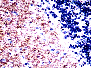 GLS Antibody