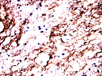 GLS Antibody