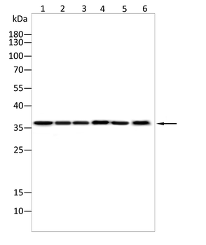 GLS Antibody