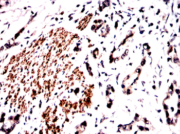 GLS Antibody