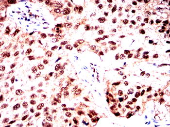 DCP1A Antibody