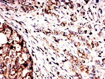 DCP1A Antibody