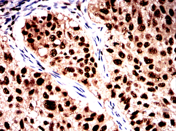 DCP1A Antibody