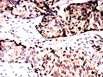 DCP1A Antibody