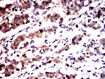 DCP1A Antibody
