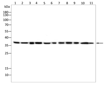 AKR1C1/AKR1C2 Antibody