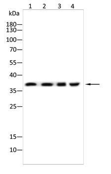 AKR1C1/AKR1C2 Antibody