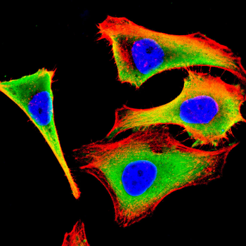 AKR1C1/AKR1C2 Antibody