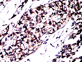 AKR1C1/AKR1C2 Antibody