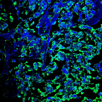 AKR1C1/AKR1C2 Antibody