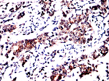 AKR1C1/AKR1C2 Antibody