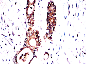 AKR1C1/AKR1C2 Antibody