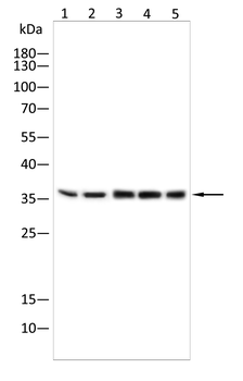 AKR1C1/AKR1C2 Antibody