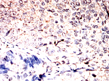 G6PD Antibody