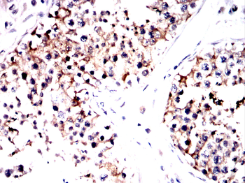 G6PD Antibody