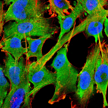 G6PD Antibody