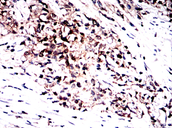 G6PD Antibody