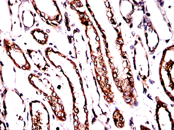 G6PD Antibody