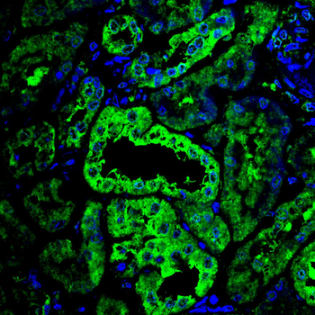G6PD Antibody