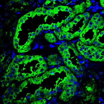 G6PD Antibody