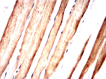 G6PD Antibody