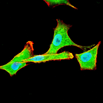 A2M Antibody