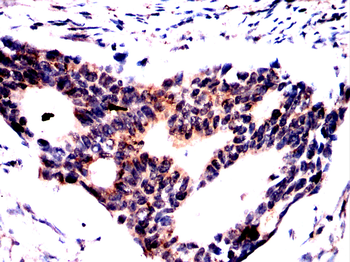 DMD Antibody