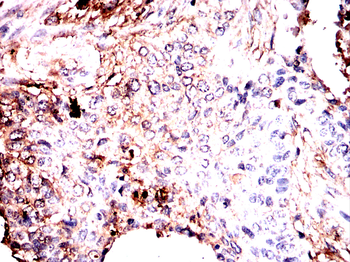 DMD Antibody