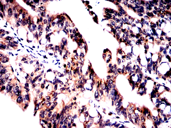 DMD Antibody