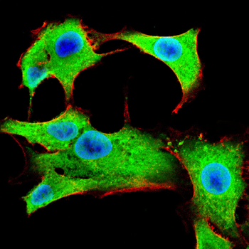 BTRC Antibody