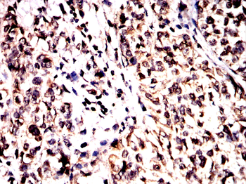 BTRC Antibody
