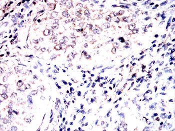 BTRC Antibody