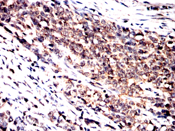 BTRC Antibody